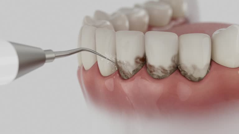 Reliable Dental contractor in Kirkwood, MO by Dentist Open Now